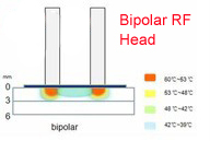 Elight + de Bipolaire rf-Machine van de Haarverwijdering met wit lichaamshuid